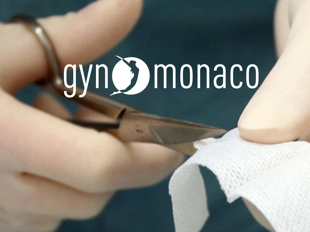 Gyn Monaco